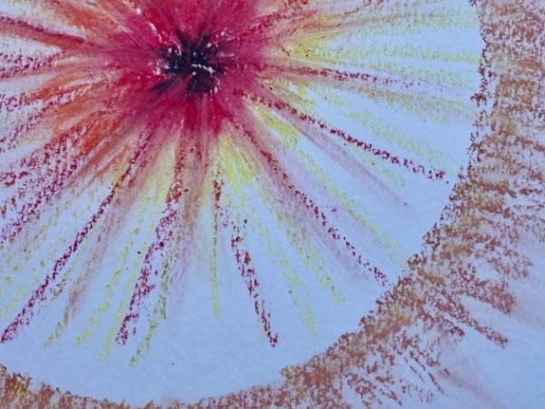 What if your diagnosis is actually a&nbsp;Superpower?